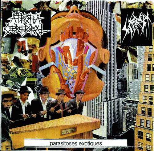 Atrofia Cerebral : Atrofia Cerebral - Sete Star Sept